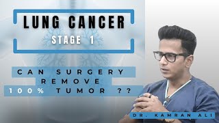Stage 1 Lung Cancer: What You NEED to Know