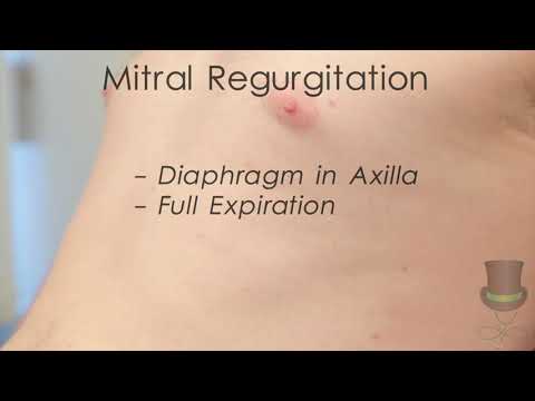Cardiology - Assessing Cardiac Murmurs using Dynamic Manoeuvres