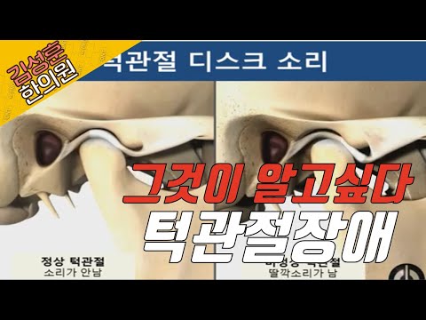 스트레스가 턱을 망가뜨리는 방법