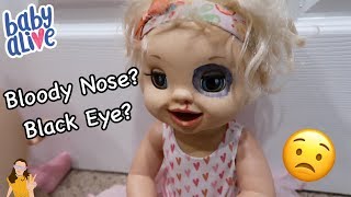 Baby Alive Emma Gets a Black Eye &amp; Bloody Nose?! 😳 | Kelli Maple