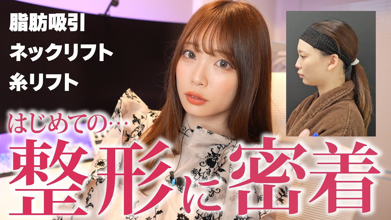 人生はじめての整形。一週間ダウンタイム→３か月後の経過 【 BLINC CLINIC 小顔整形 脂肪吸引＆ネックリフト＆糸リフト 】