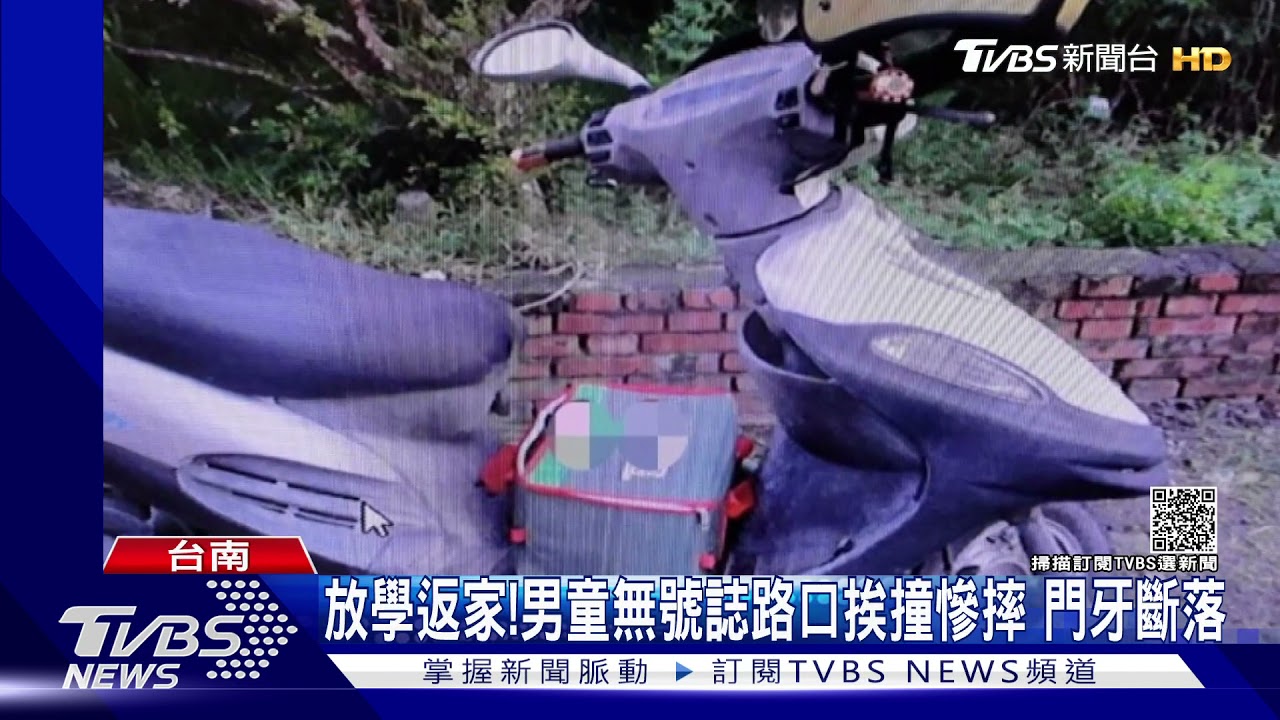 男童無號誌路口挨撞慘摔門牙斷 媽媽目擊嚇壞了