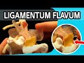 View 15 Ligamentum Flavum