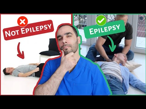 You DO NOT have Epilepsy