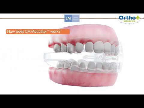 LM Activator! Come utilizzarli?