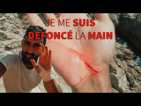 JE ME SUIS DÉFONCÉ LA MAIN !