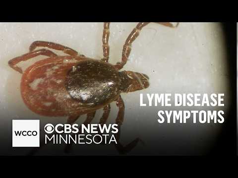 Woman with chronic Lyme disease shares misdiagnosis story | Talking Points