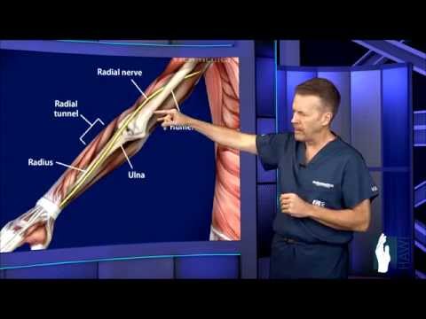 Radial Tunnel Surgery