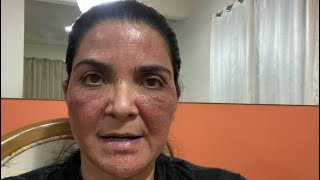 FIZ JATO DE PLASMA OLHA O QUE ACONTECEU