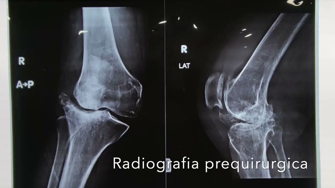 Carlos Eduardo Uribe Saloma-17