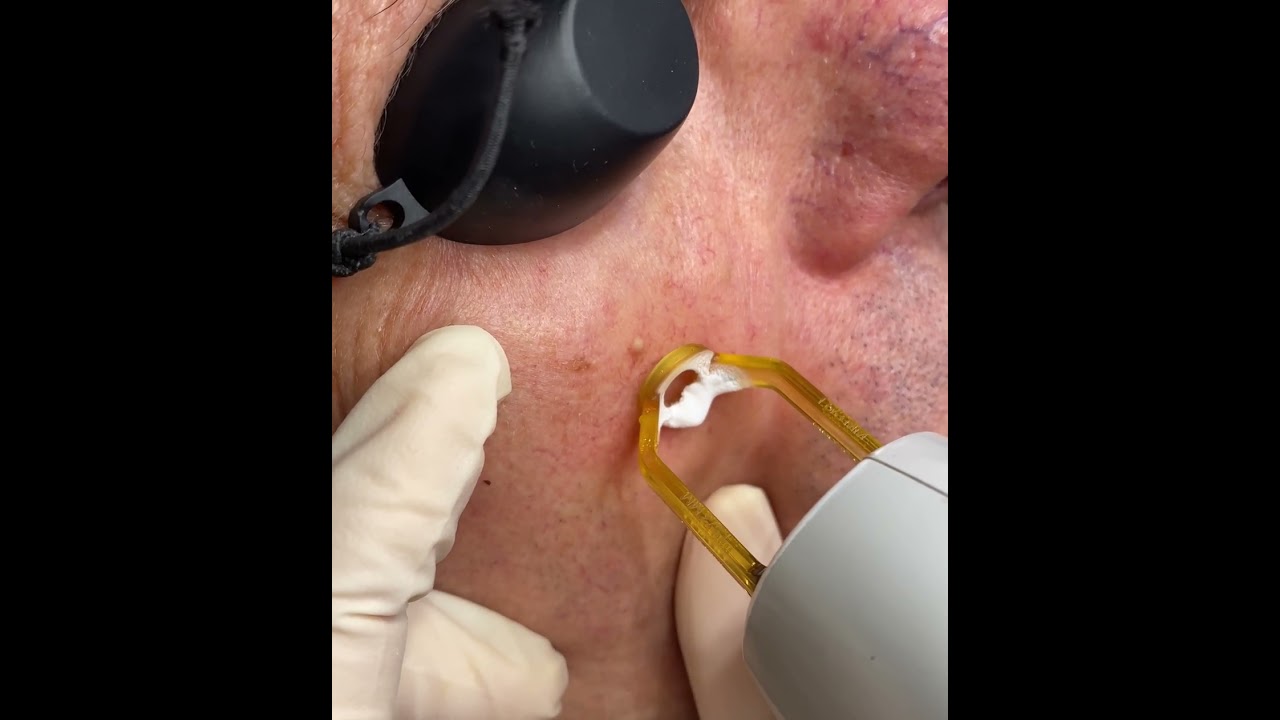 Giovanni Montesarchio-8