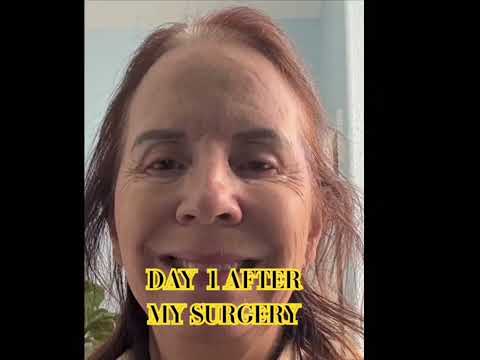 Cataract Surgery Recovery:  My First 7 Days After Right Eye Surgery