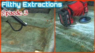 Simply EXTRACTIONS | FILTHY Deep Cleaning  Ep 3