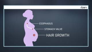 VERIFY: Baby or Bust - Myths about pregnancy and hair