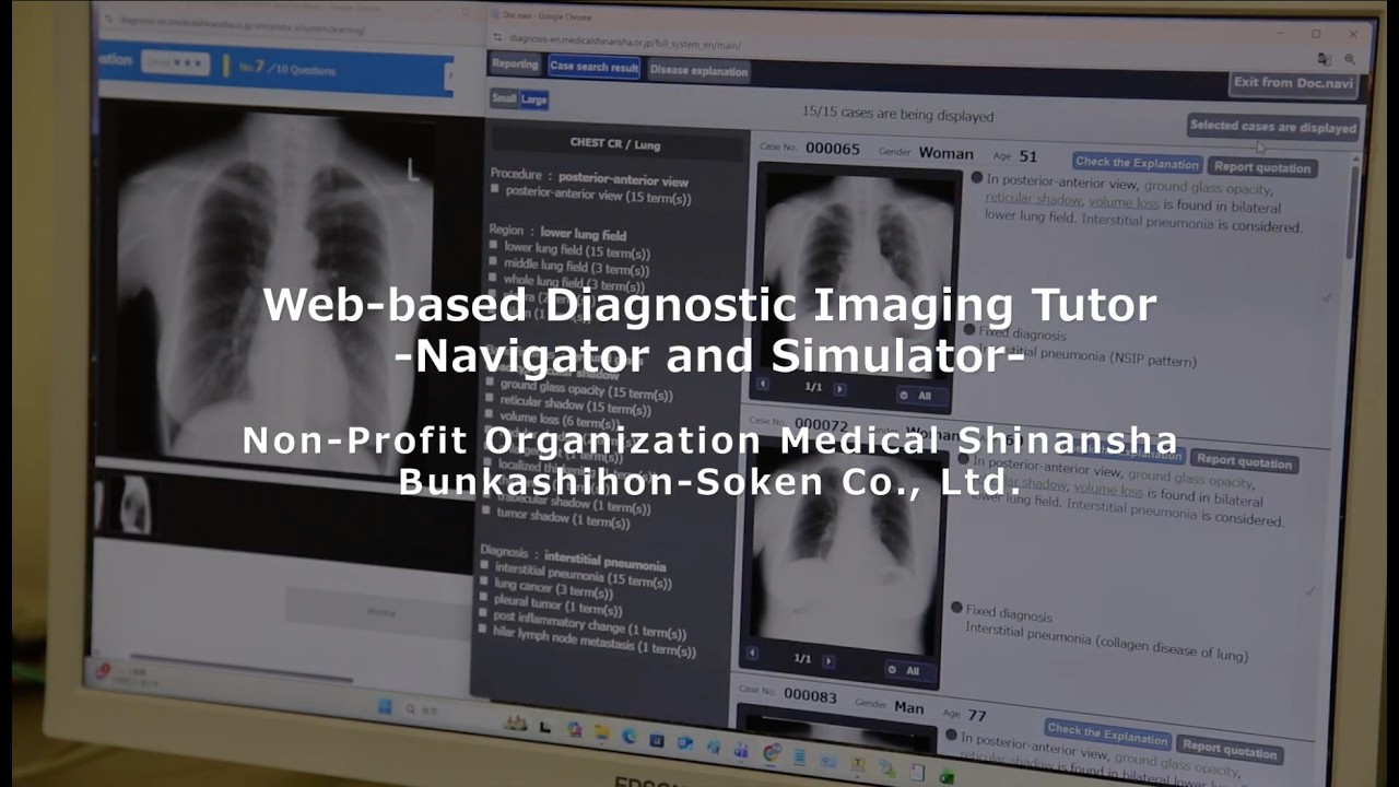 Web-based Diagnostic Imaging Tutor -Navigator and Simulator-