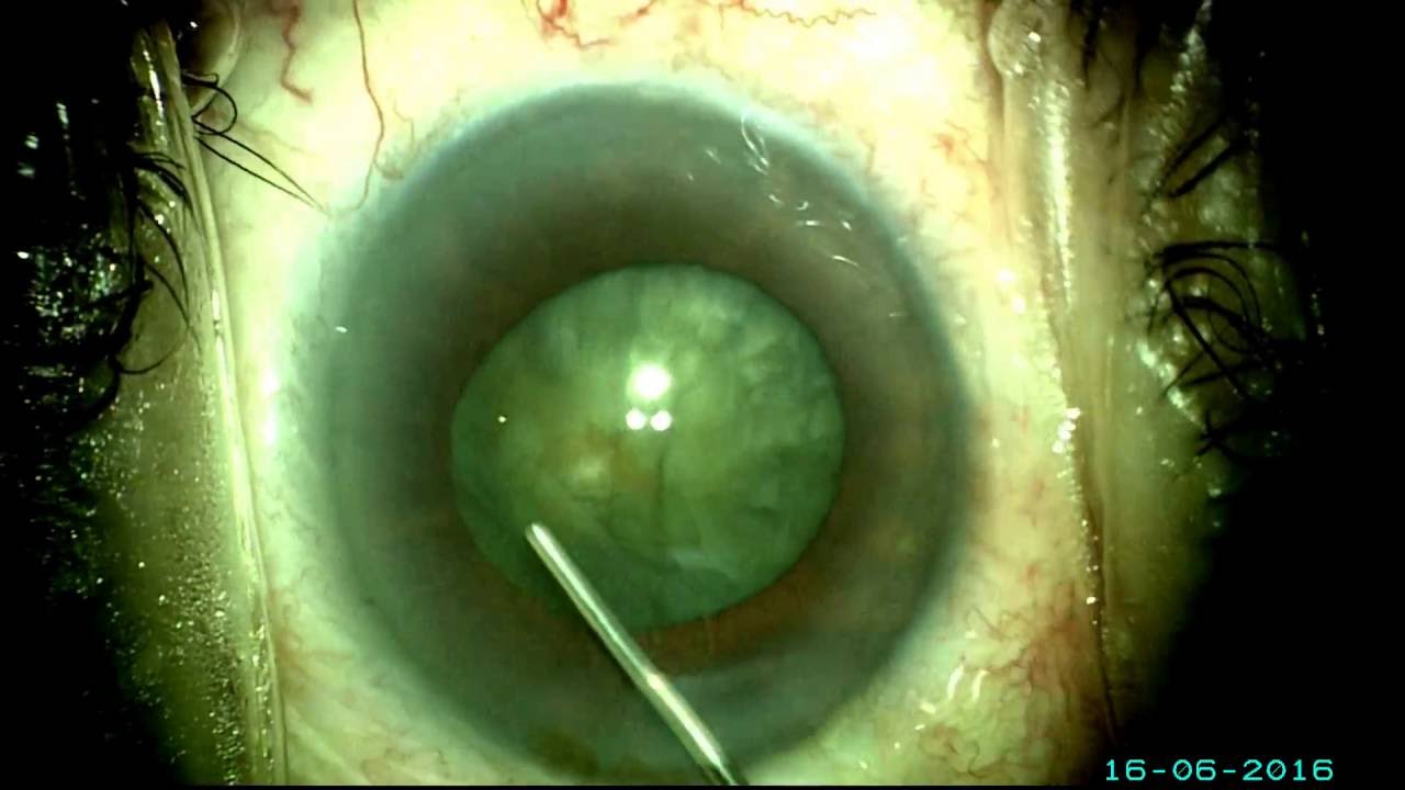 Rodolfo Benavides Villarreal-7