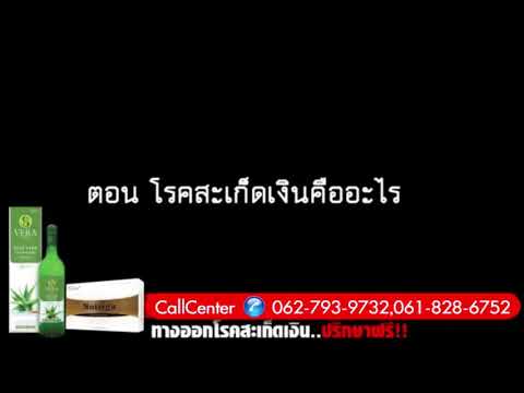 กลากบุหรี่ภาพมือ ส่วนที่ 2 ASD สำหรับโรคสะเก็ดเงินของมนุษย์