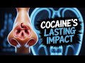 STOP Ignoring These 3 Cocaine Nose Damage Warning Signs