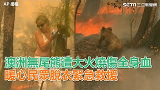 無尾熊遭大火燒傷全身血　暖心民眾脫衣救援