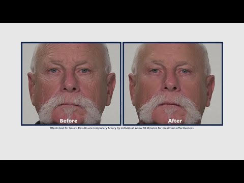 Plexaderm helps fight wrinkles