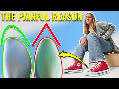 Why your shoes hurt your feet