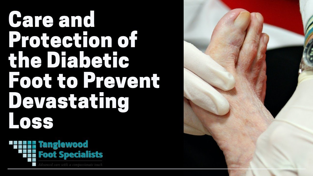 Care and Protection of the Diabetic Foot to Prevent Devastating Loss