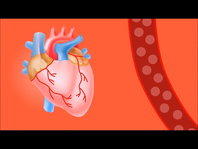 kalp agrisina ne iyi gelir 10 dogal tedavi nefis yemek tarifleri