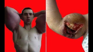 ДОИГРАЛСЯ С СИНТОЛОМ. Кирилл Терёшин
