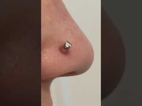 How to get rid of a piercing bump #piercings #piercingbump #keloid #teatreeoil #piercinglife #howto