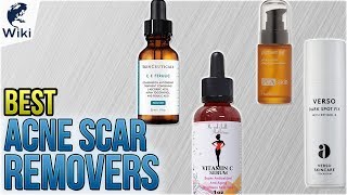 10 Best Acne Scar Removers 2018