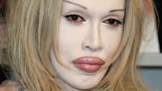 The Tragedy Of Pete Burns Is Simply Heartbreaking