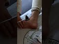 Ankle reflex