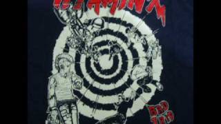 19 - Vitamin X - Burn'em down