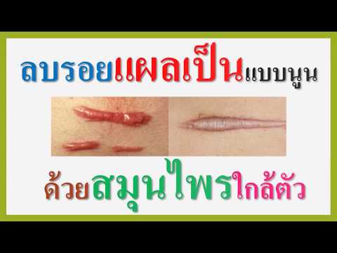 หัวนมหน้าอกเล็ก หน้าอกหลังผ่าตัดขนาดแตกต่างกัน