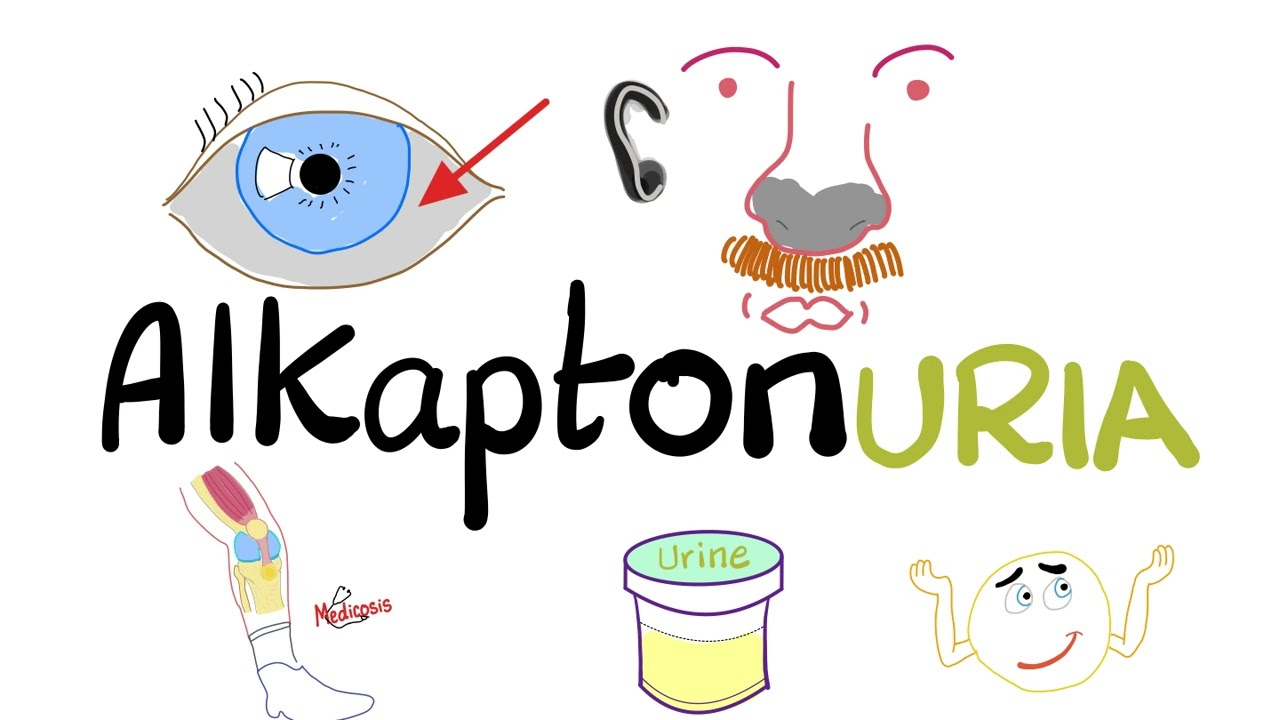 Alkaptonuria (Ocronosis) - Homogentisic Acid Oxidase Deficiency - Biochemistry - YouTube