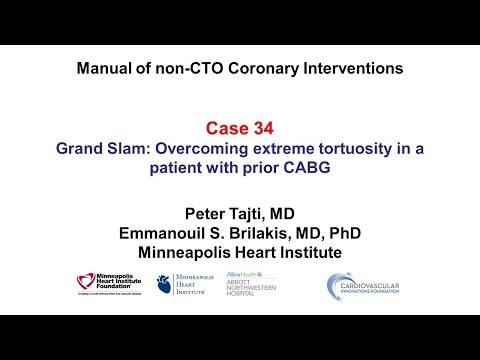 Case 34: PCI Manual: Delivery in tortuosity