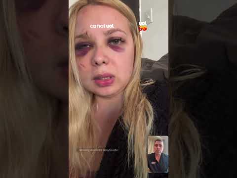 Jovem agredida em estação de SP diz que suspeito foi solto no mesmo dia