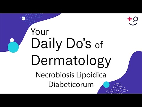 Necrobiosis Lipoidica Diabeticorum - Daily Do's of Dermatology