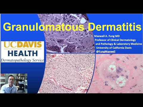 DERMATOPATHOLOGY: Granulomatous Dermatitis