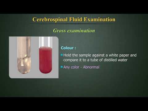 Cerebrospinal Fluid Examination (CSF)