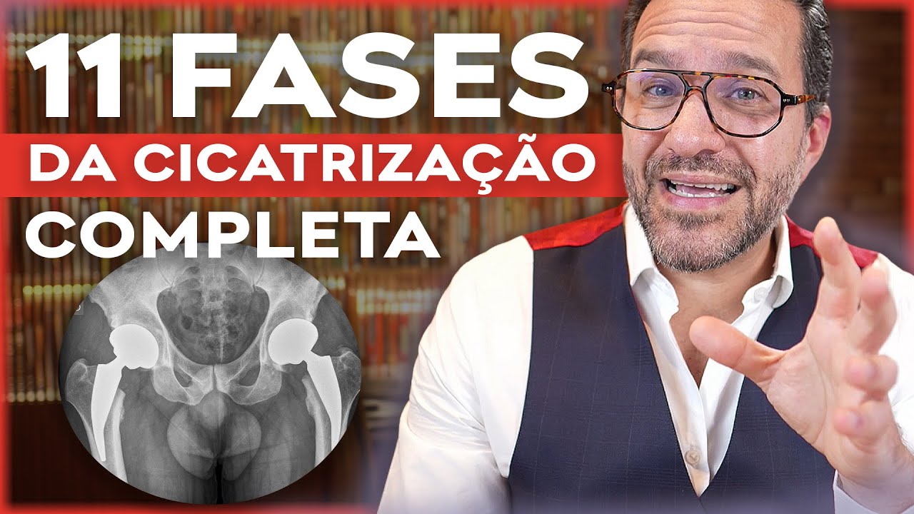 QUANTO TEMPO leva pra CICATRIZAÇÃO completa da CIRURGIA de prótese de quadril?