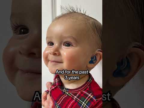 We found out why our son is Deaf... #shorts