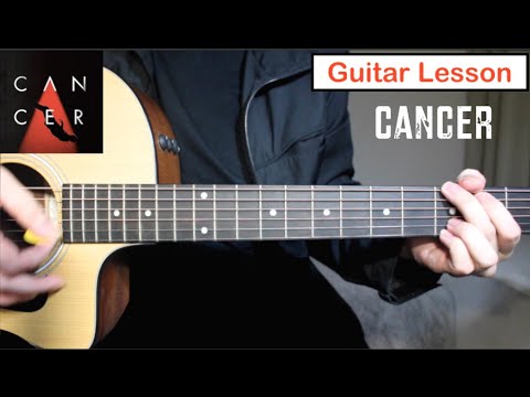 download lagu mp3 mp4 Cancer Guitar Tab, download mp3 Cancer Guitar Tab free download, download mp3 Cancer Guitar Tab