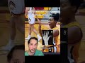 Pull that finger…and it should go back in nicely #Finger #Joint #Bone #Injury #Basketball #Medical