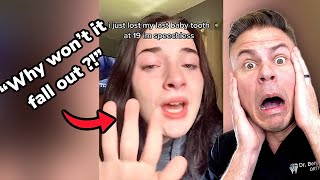 19 Year Old Baby Tooth?! Orthodontist Reacts!