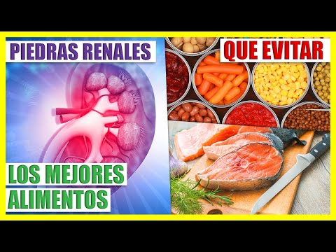 Alimentos Para Eliminar o Evitar Cálculos Renales - Tratamientos Naturales Para La Litiasis Renal