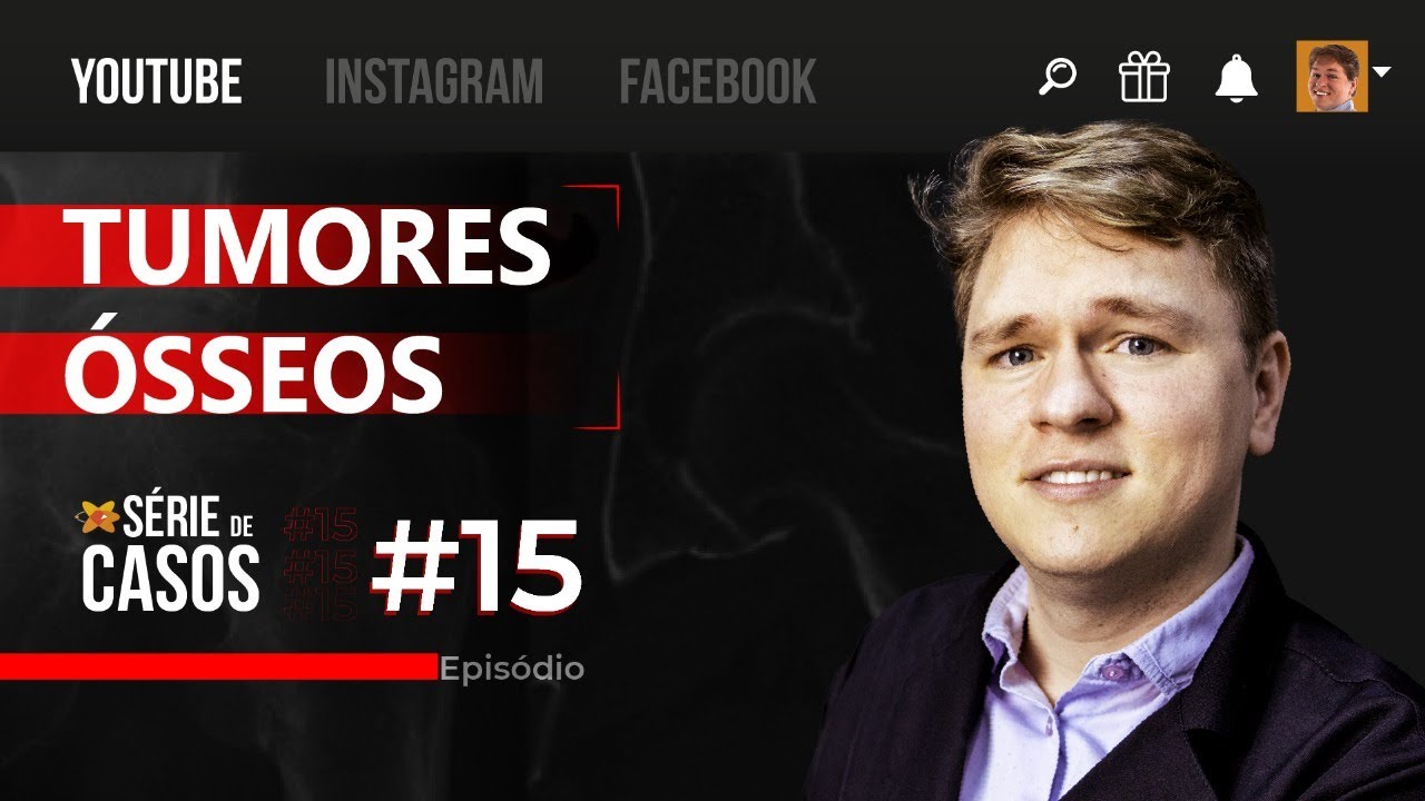 Diagnóstico diferencial dos Tumores Ósseos | Série de Casos no Rx #15