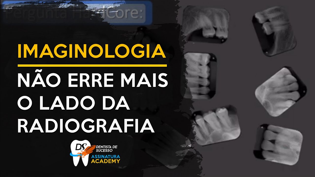 4 Dicas para leitura de região de Radiografias Periapicais | IMAGINOLOGIA