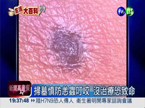 清明掃墓防恙蟲 長袖衣褲護身!