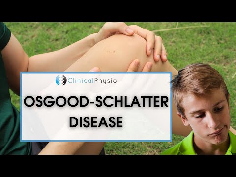 Morbus Osgood-Schlatter | Was ist das? Wie wird er behandelt?